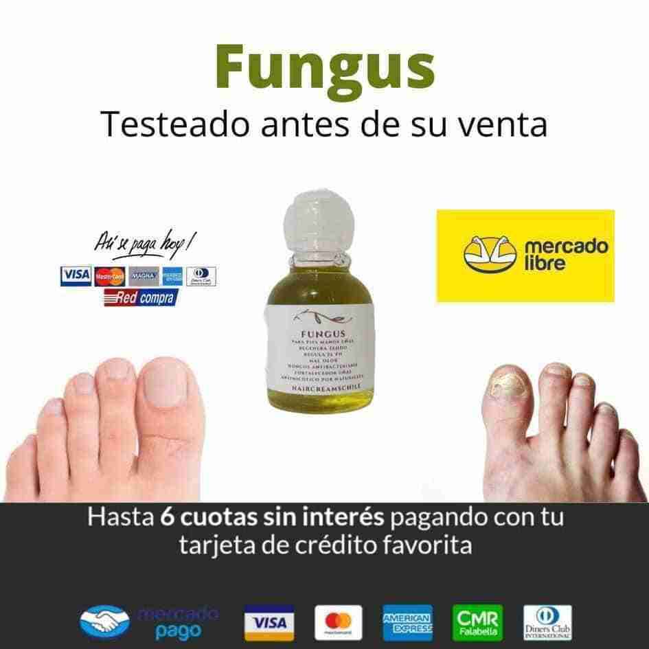 Tratamiento antihongos Fungus 30 ml - miniatura 6