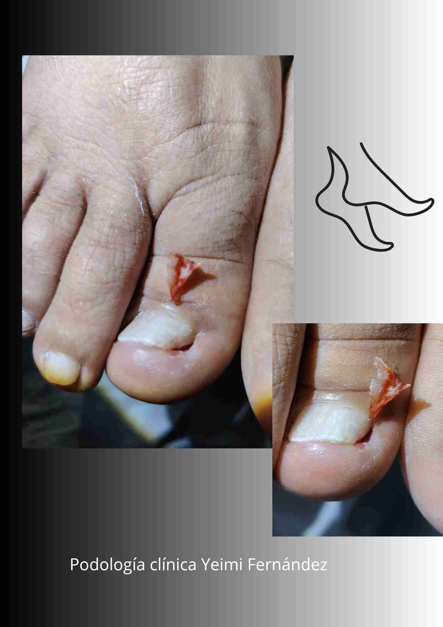 Podología clínica a domicilio Región metropolitana - miniatura 1