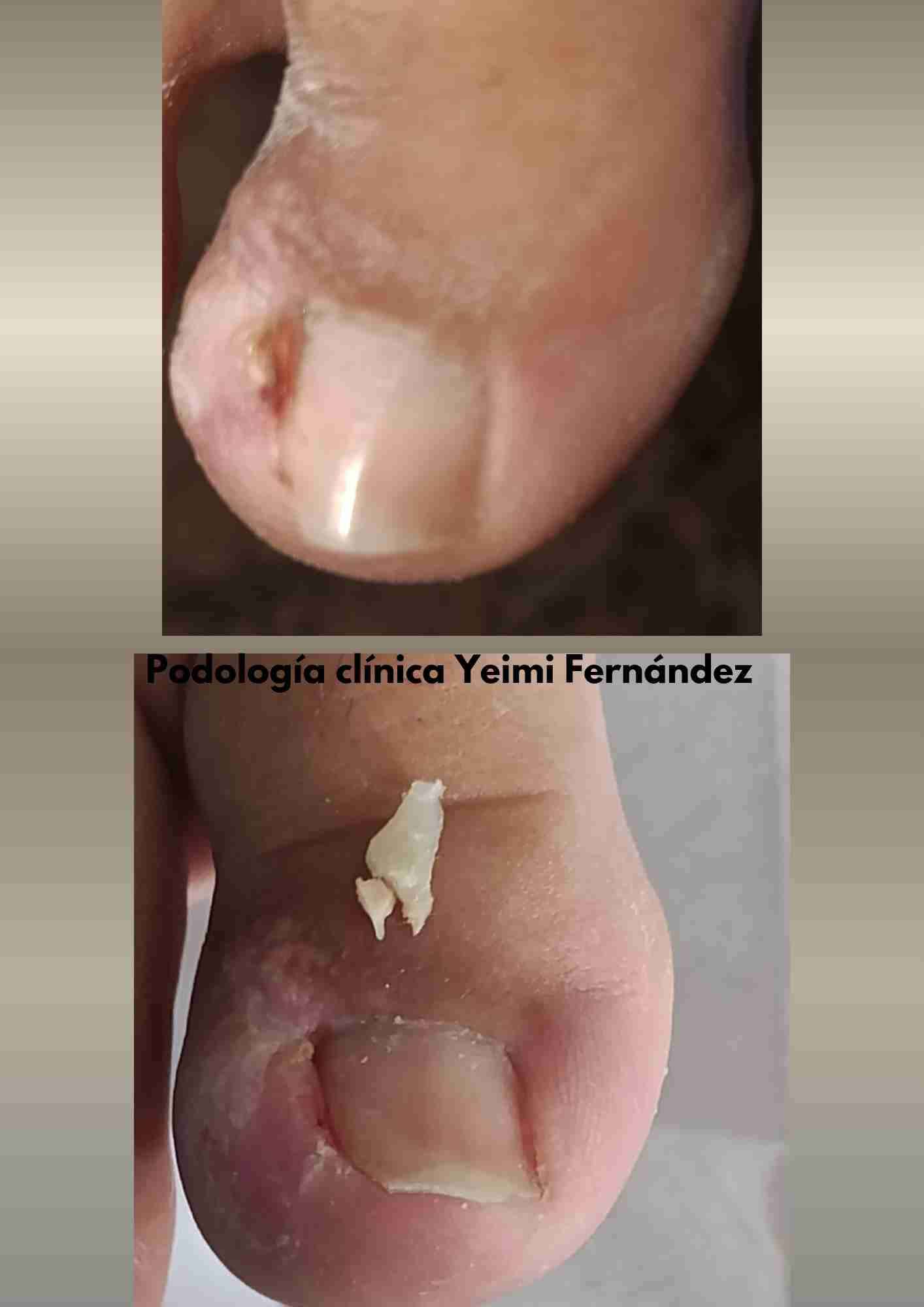 Podología clínica a domicilio Región metropolitana - miniatura 2