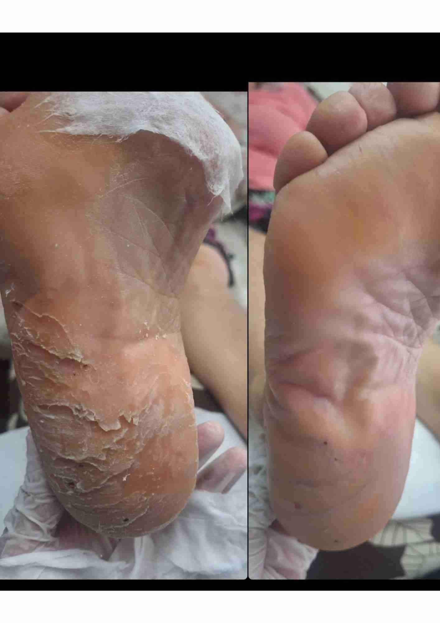 Podología clínica a domicilio Región metropolitana - miniatura 4