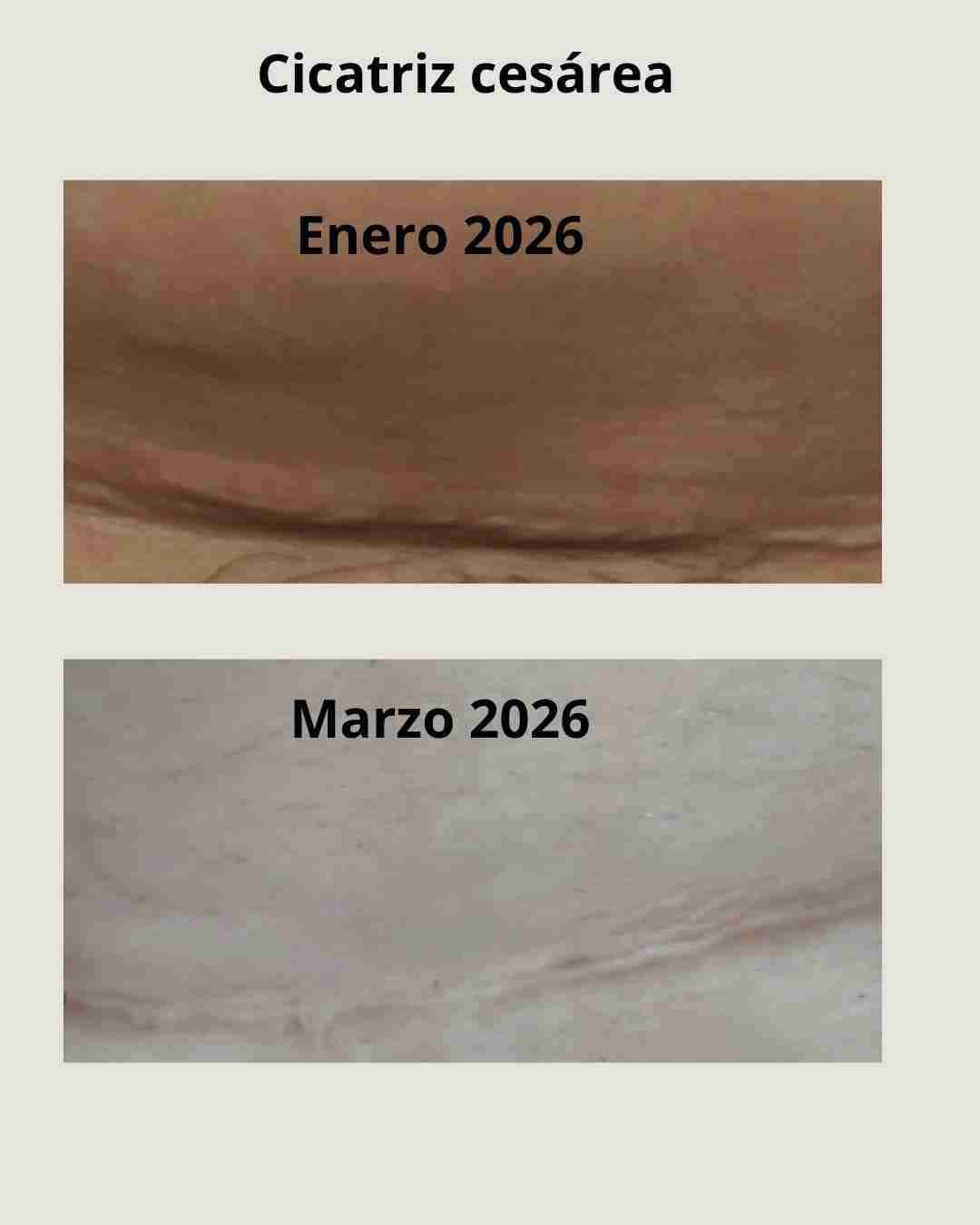 Renova+ Original.     Embajador oficial - miniatura 1