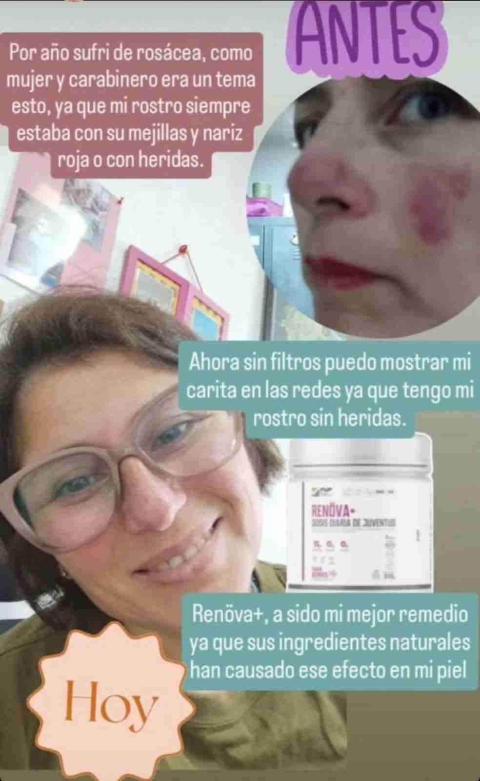 Renova+ Original.     Embajador oficial - miniatura 2