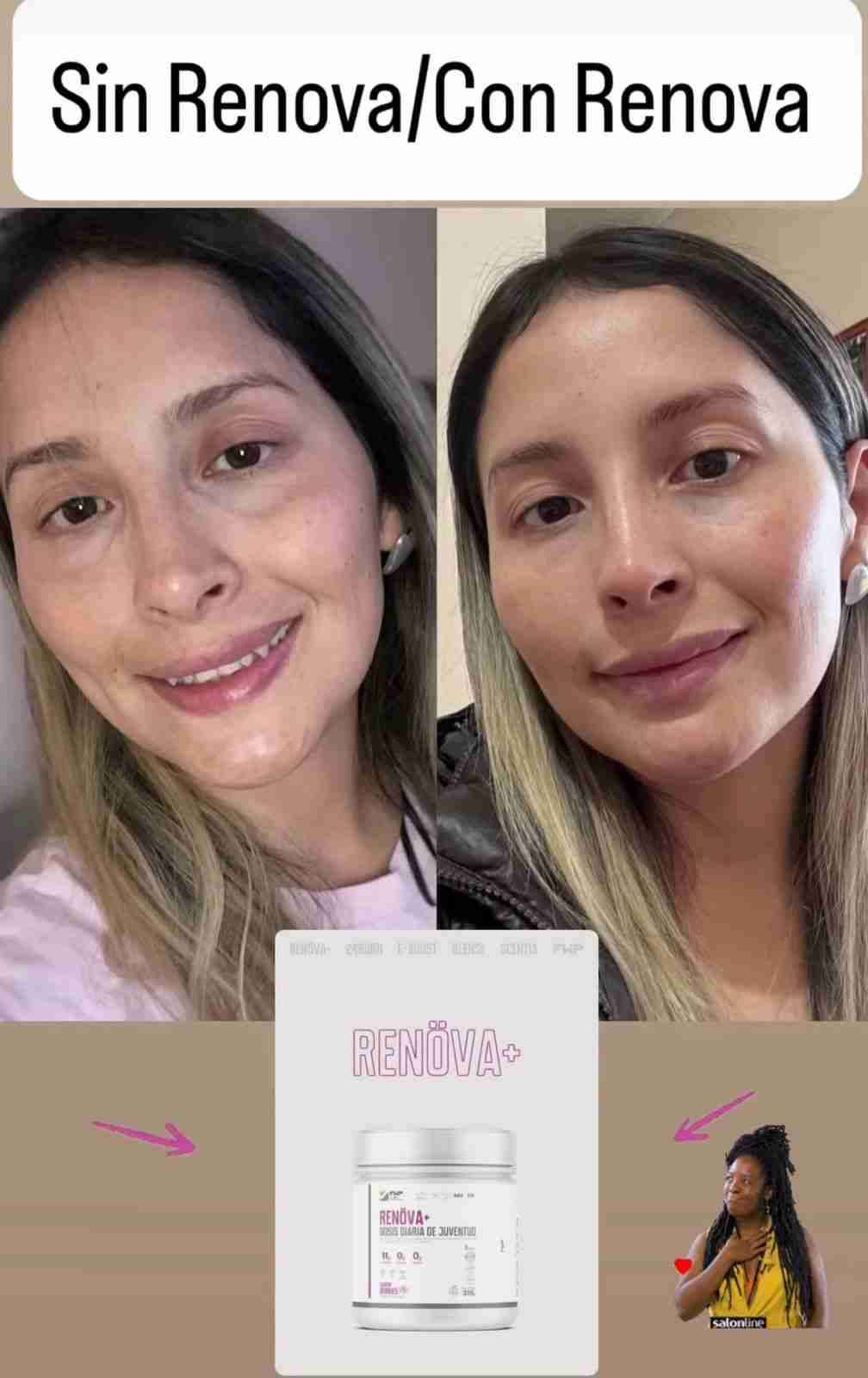 Renova+ Original.     Embajador oficial - miniatura 3