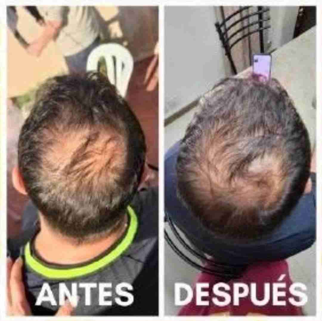 Renova+ Original.     Embajador oficial - miniatura 4